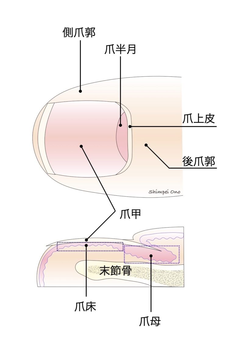 【Step by Step 手術手技】爪甲脱臼を伴う指挫滅創の初期対応｜Schiller法・爪母癒着予防 - マイナー外科・救急