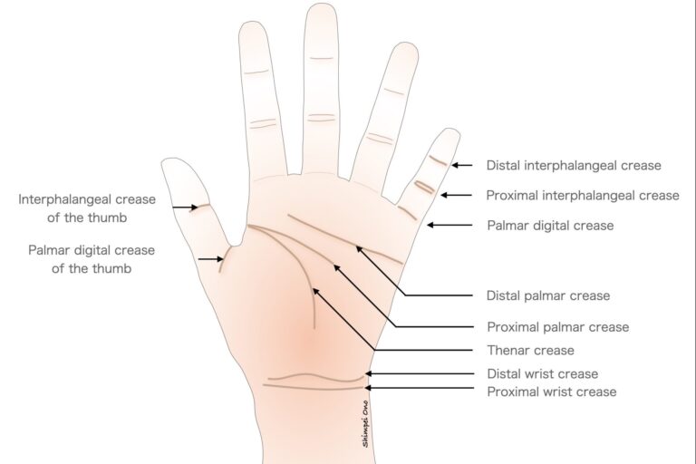 【Clinical Tips】Anatomy: Hand and Finger Creases - マイナー外科・救急