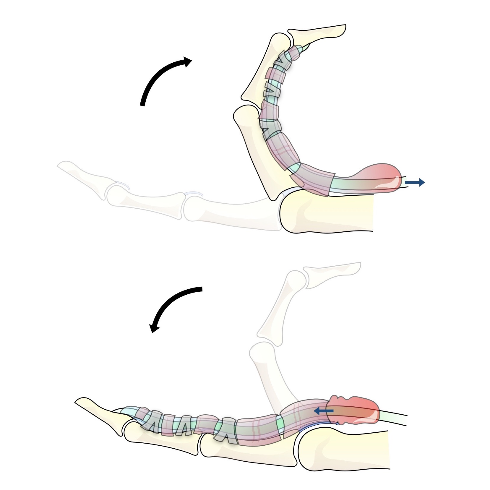 構造医学　ばね指処方ローラー（弾発指処方転子） ばね指｜ユービケア｜小林製薬